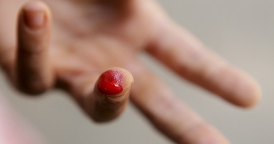 Los investigadores han concluido que se da una reducción de dos tercios en los casos de paludismo, incluidos los casos más graves, y en el número de fallecimientos/ Foto: cortesía EFE