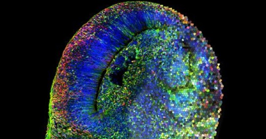 El punto de partida de la investigación es un organoide cerebral, la versión milimétrica del cerebro humano fabricada, mediante métodos de cultivo celular, en el laboratorio/ Foto: cortesía EFE