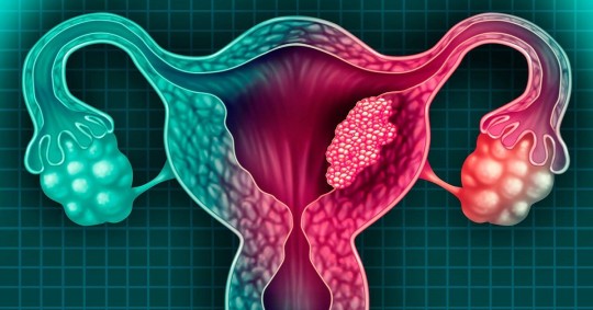 Esta enfermedad se relaciona con el Virus del Papiloma Humano (VPH), el cual es transmitido sexualmente/ Foto: Cortesía