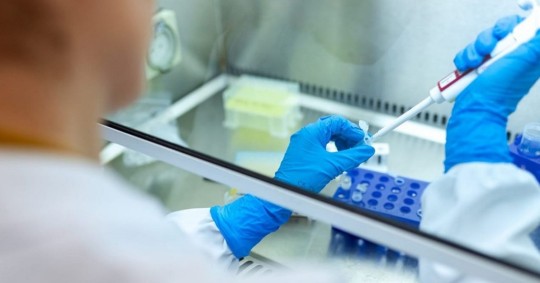 El Ministerio señaló que de los 185 casos, 67 han sido dados de alta y se mantiene el cerco epidemiológico de 308 contactos / Foto: cortesía ministerio de Salud