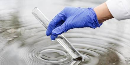 Las provincias amazónicas son las más afectadas por la bacteria E. coli